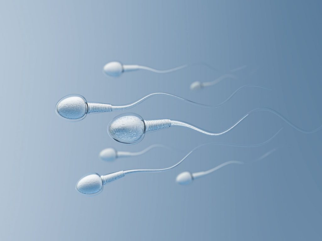 Sperm preparation