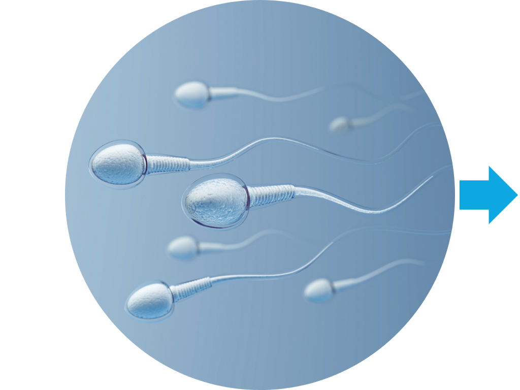 Sperm preparation